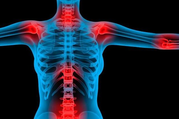 Fibromialgia – LC Zona B II^ Circoscrizione, 19 febbraio 2026